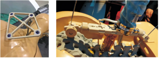 peek-star-wheel-11-600x232-1 peek-star-wheel-11-600x232-1